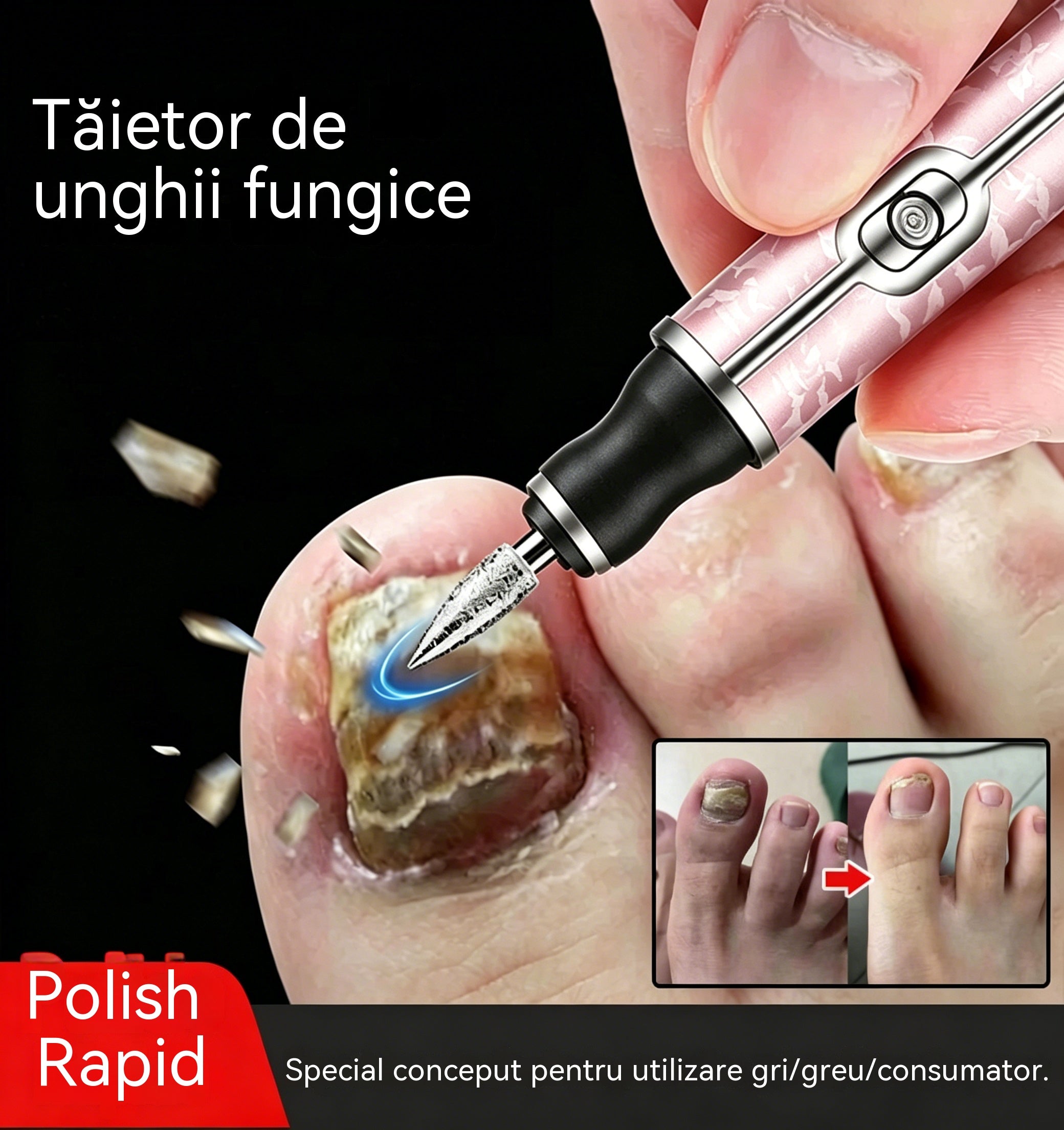 💅👍Pilă electrică de unghii pentru tratamentul onicomicozei